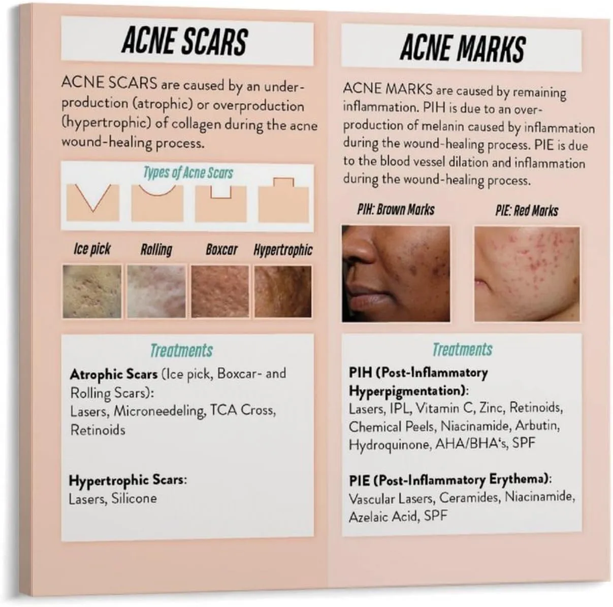 How to Treat Acne Scars And Marks Poster Dermatology PosterWall Poster Art Canvas Printing Living Room Office Bedroom Aesthetic Poster 20x20inch(50x50cm) Frame-style