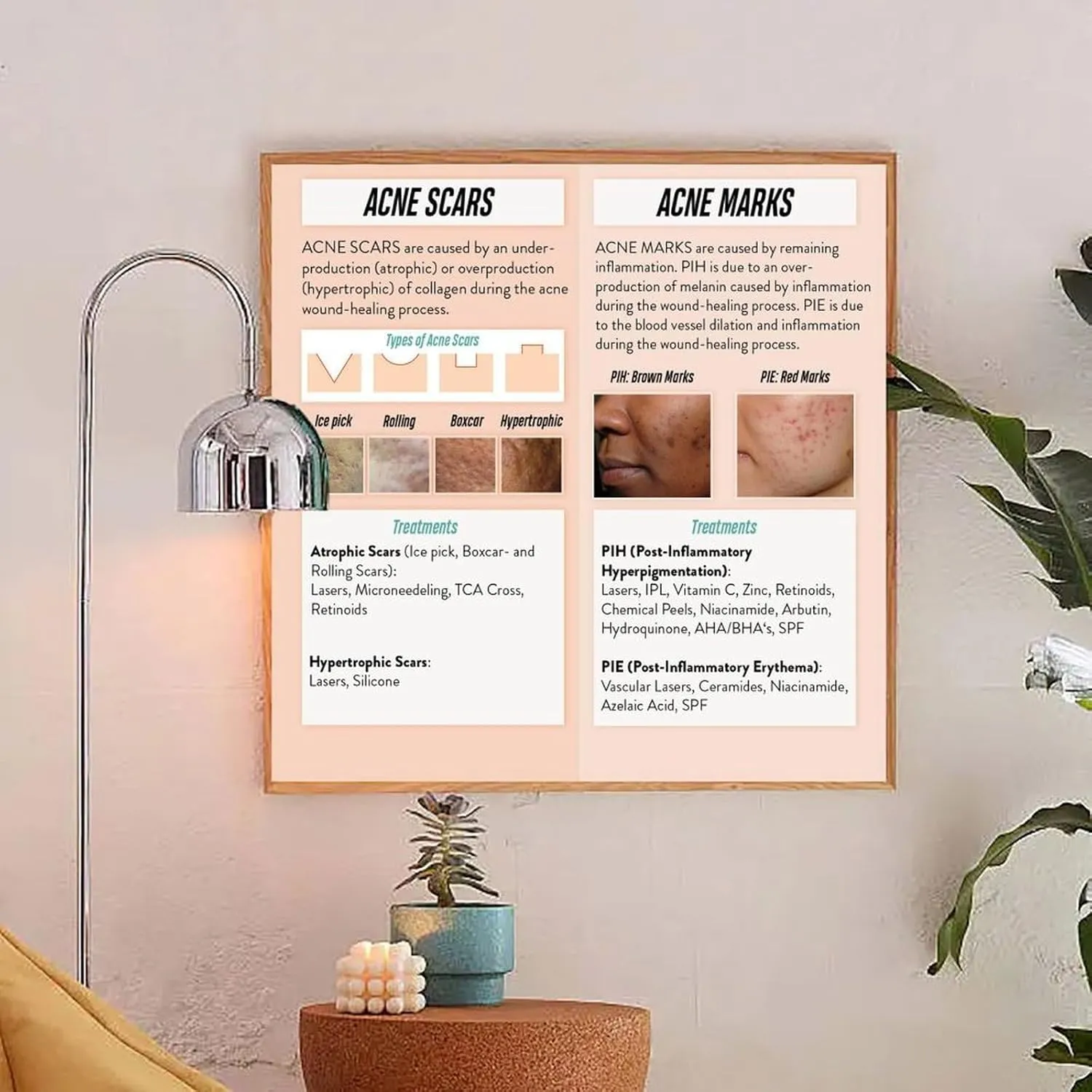 How to Treat Acne Scars And Marks Poster Dermatology PosterWall Poster Art Canvas Printing Living Room Office Bedroom Aesthetic Poster 20x20inch(50x50cm) Frame-style