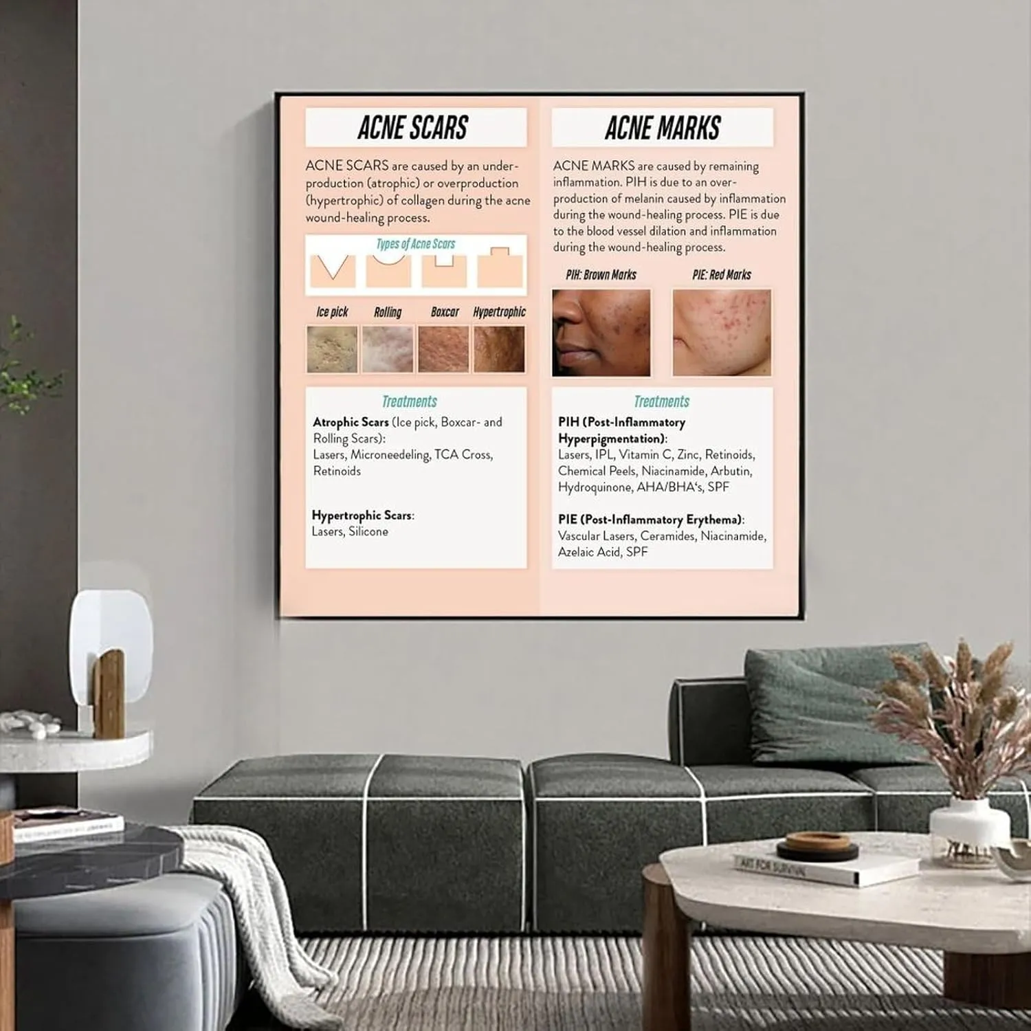 How to Treat Acne Scars And Marks Poster Dermatology PosterWall Poster Art Canvas Printing Living Room Office Bedroom Aesthetic Poster 20x20inch(50x50cm) Frame-style