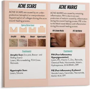 How to Treat Acne Scars And Marks Poster Dermatology PosterWall Poster Art Canvas Printing Living Room Office Bedroom Aesthetic Poster 20x20inch(50x50cm) Frame-style